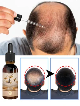 Unisex Saç Büyüme Yağı Saç Dökülmesi Tedavisi Hızlı Saç Büyüme Etkili Kellik Onarım Kalıtsal Doğum Sonrası Saç Dökülmesi